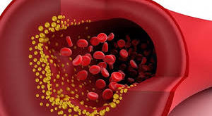 تحليل نسبة الكوليسترول في الدم